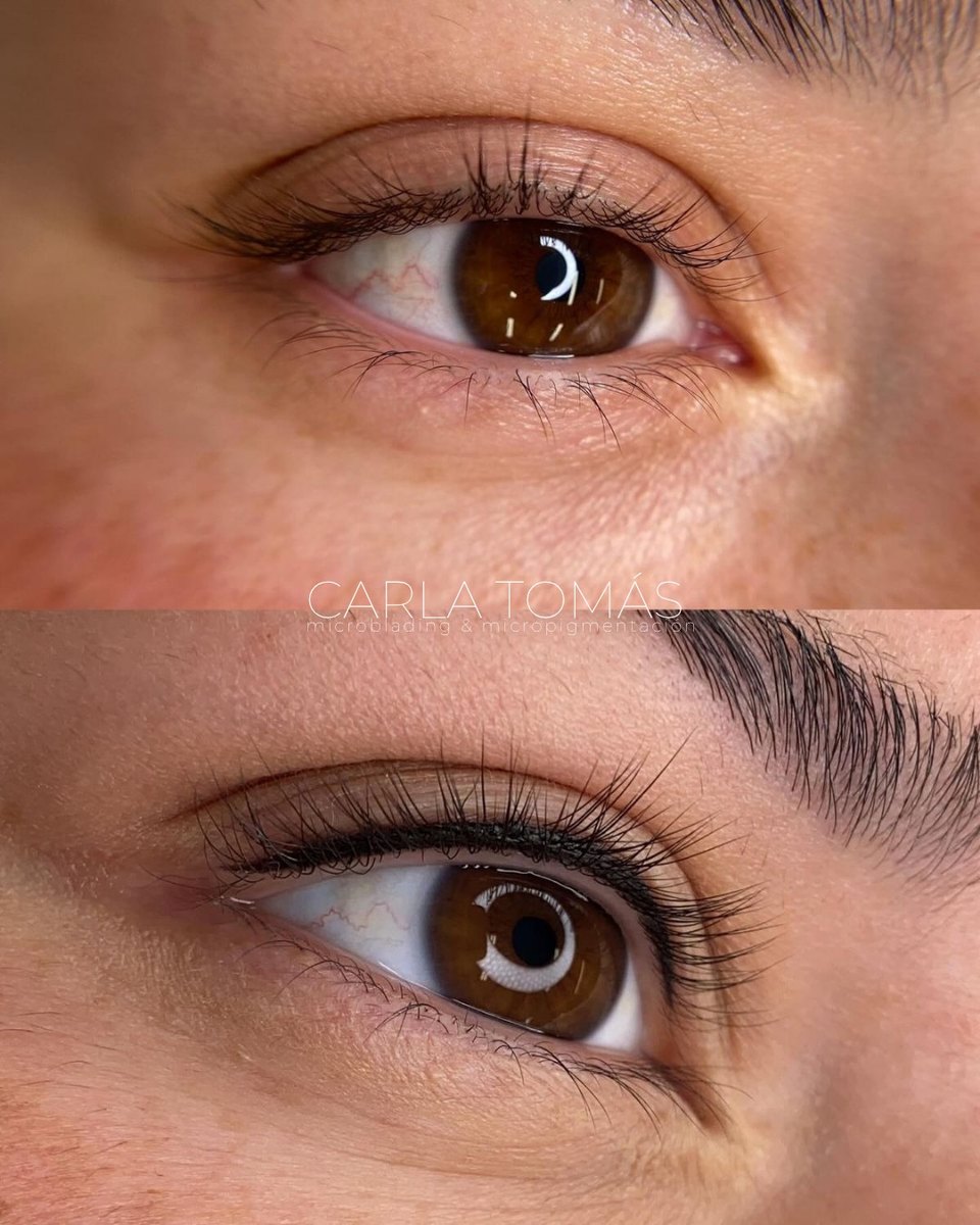 Antes y después de micropigmentación de eyeliner en Daroca, Carla Tomás