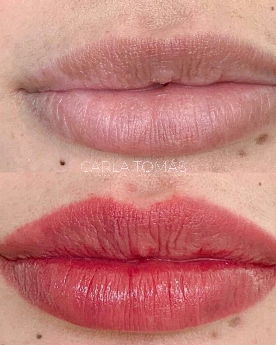 Micropigmentación de labios con efecto color en Calamocha, antes y después frontal, Carla Tomás