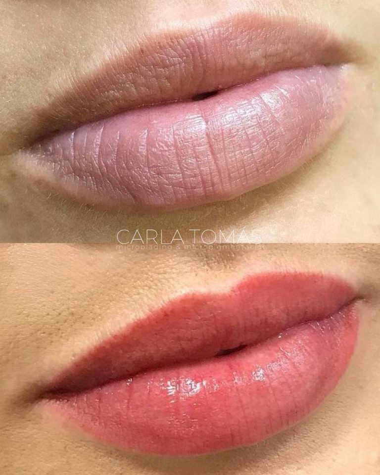 Micropigmentación de labios para unificar color en Calamocha, antes y después, Carla Tomás