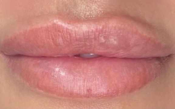 Cejas antes del micropigmentación de labios, clienta de Calamocha, Carla Tomás