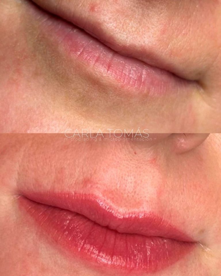 Antes y después de micropigmentación de labios en Daroca, color natural, Carla Tomás