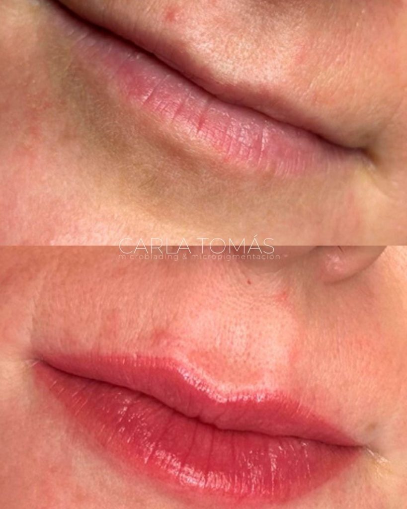 Antes y después de micropigmentación de labios en Zaragoza, color natural, Carla Tomás